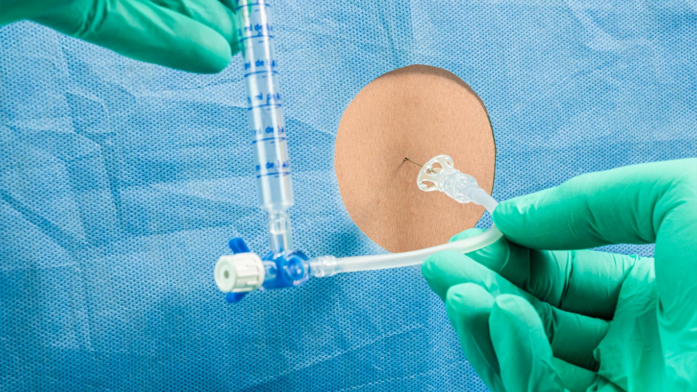 Bone and Joint Orthopedic Clinic Consultation services epidural injections Epidural Injections Pain Management heailBOX Medical Clinics 1 Bone and Joint Orthopedic Clinic Consultation services epidural injections