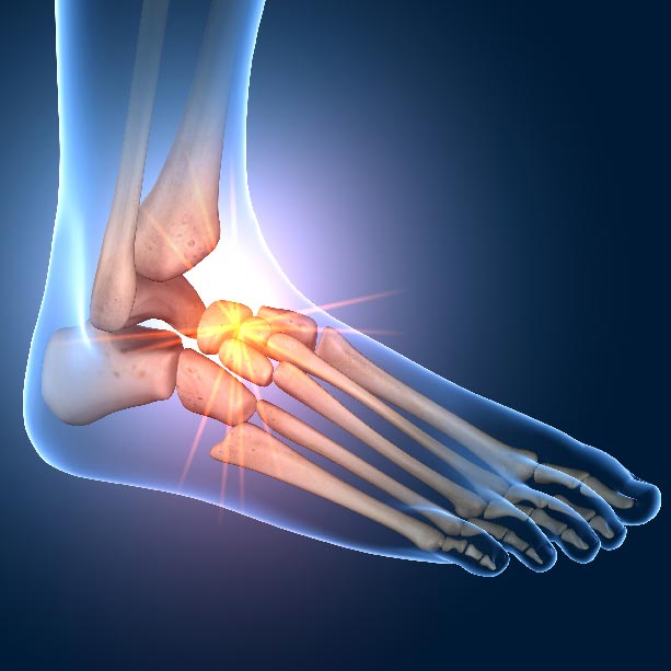 Bones and Joints X RAY 3D feet square Joint Pain Treatment Muscle Relief heailBOX Medical Clinics 6 Bones and Joints X RAY 3D feet square