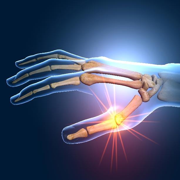 Bones and Joints X RAY 3D hands square Joint Pain Treatment Muscle Relief heailBOX Medical Clinics 3 Bones and Joints X RAY 3D hands square