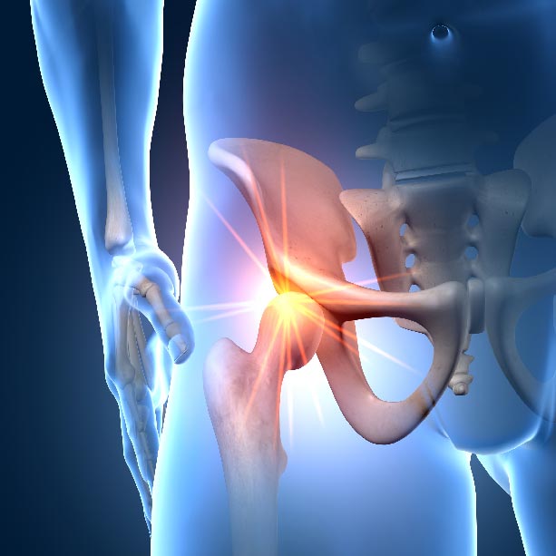 Bones and Joints X RAY 3D hip square Joint Pain Treatment Muscle Relief heailBOX Medical Clinics 4 Bones and Joints X RAY 3D hip square