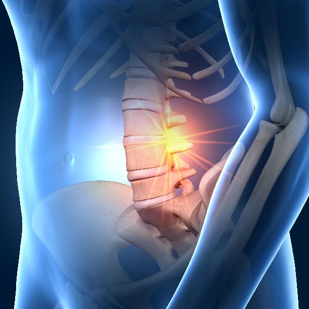 Bones and Joints X RAY 3D spine square Joint Pain Treatment Muscle Relief heailBOX Medical Clinics 1 Bones and Joints X RAY 3D spine square